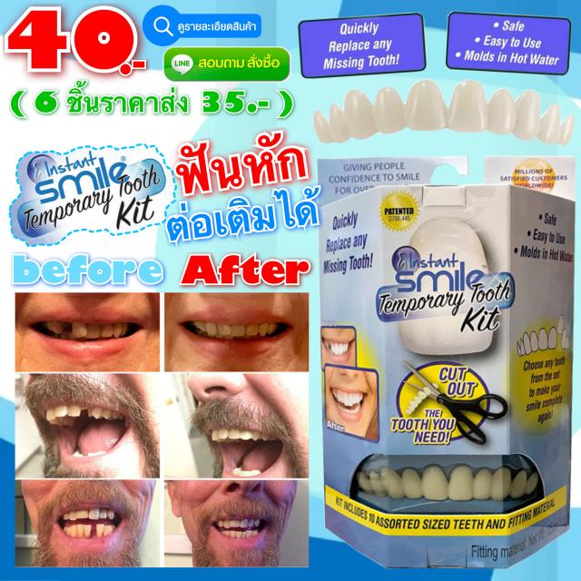 instant smile temporary tooth kit ฟันปลอมเสริมบุคลิค ราคาส่ง 35 บาท