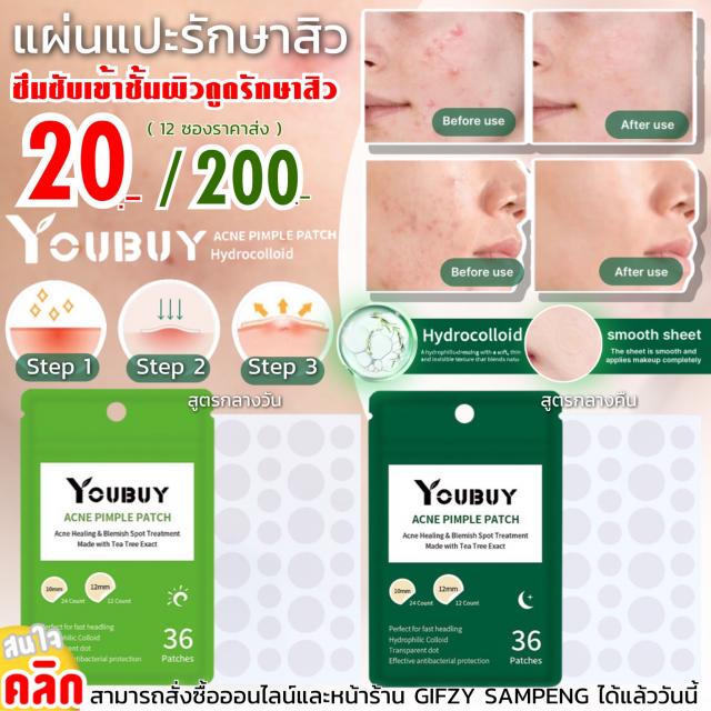 Youbuy acne pimple patch แผ่นแปะรักษาสิว 12 ซองราคา 200 บาท
