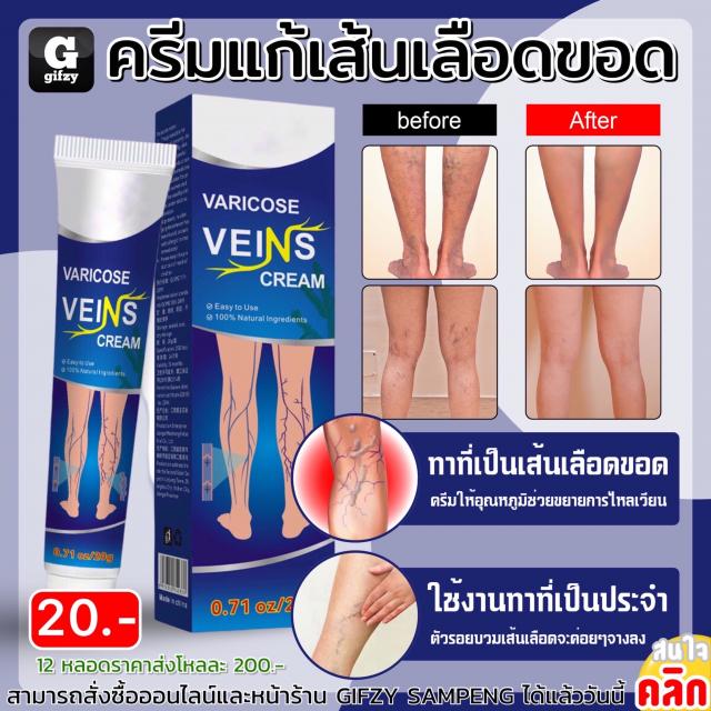 Varicose veins cream ครีมแก้เส้นเลือดขอด 12 ชิ้นราคาส่ง 200 บาท