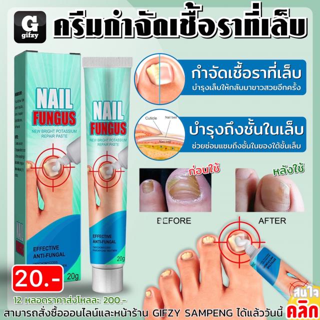 Nail fungus repair paste ครีมกำจัดเชื้อราที่เล็บ 12 ชิ้นราคาส่ง 200 บาท