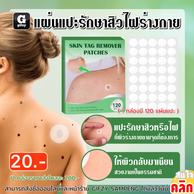 Skin tag remover patches แผ่นแปะรักษาสิวไฝที่ร่างกาย 12 ชิ้นราคาส่ง 200 บาท