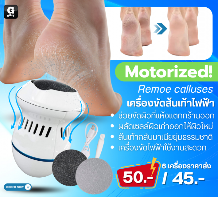 Motorized Remoe calluses เครื่องขัดส้นเท้าไฟฟ้า ราคาส่ง 45 บาท