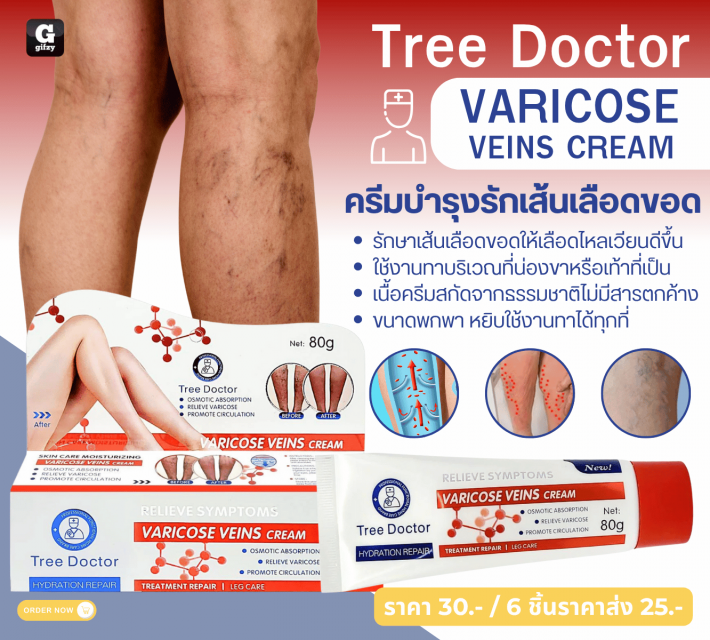 Tree Doctor VARICOSE VEINS CREAM ครีมบำรุงรักเส้นเลือดขอด ราคาส่ง 25 บาท