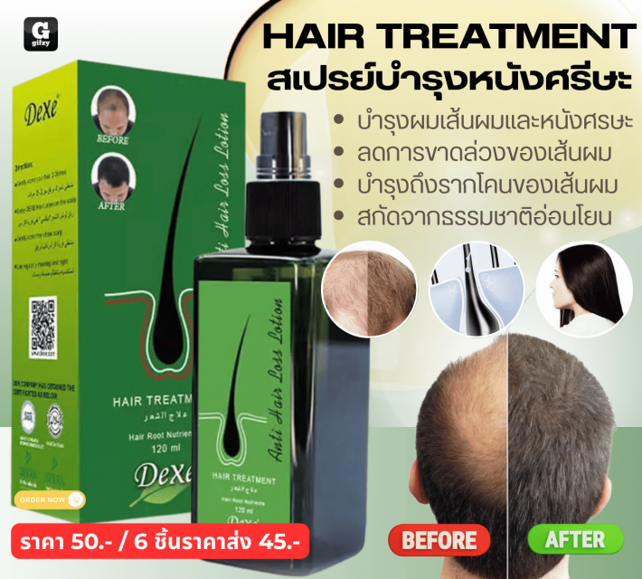 HAIR TREATMENT สเปรย์บำรุงหนังศรีษะ ราคาส่ง 45 บาท