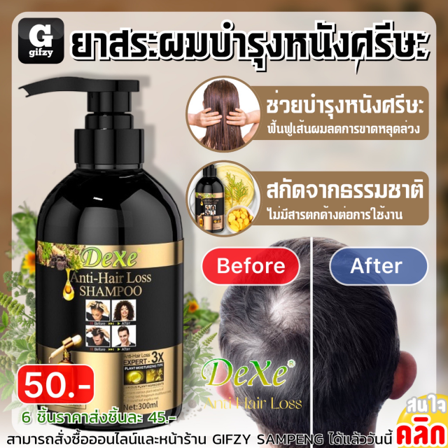 Dexe anti hair loss ยาสระผมบำรุงหนังศรีษะ ราคาส่ง 45 บาท