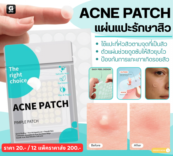 ACNE PATCH แผ่นแปะรักษาสิว 12 แพ็คราคาส่ง 200 บาท