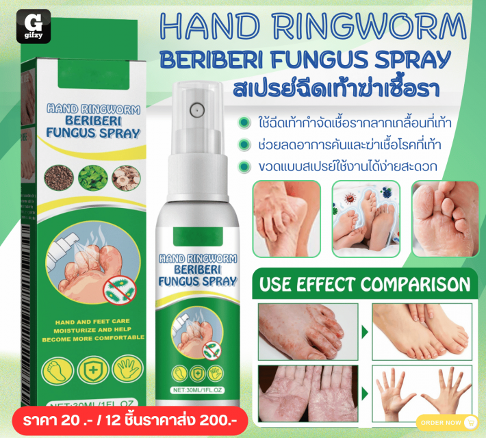 HAND RINGWORM BERIBERI SPRAY สเปรย์ฉีดเท้าฆ่าเชื้อรา 12 ชิ้นราคาส่ง 200 บาท